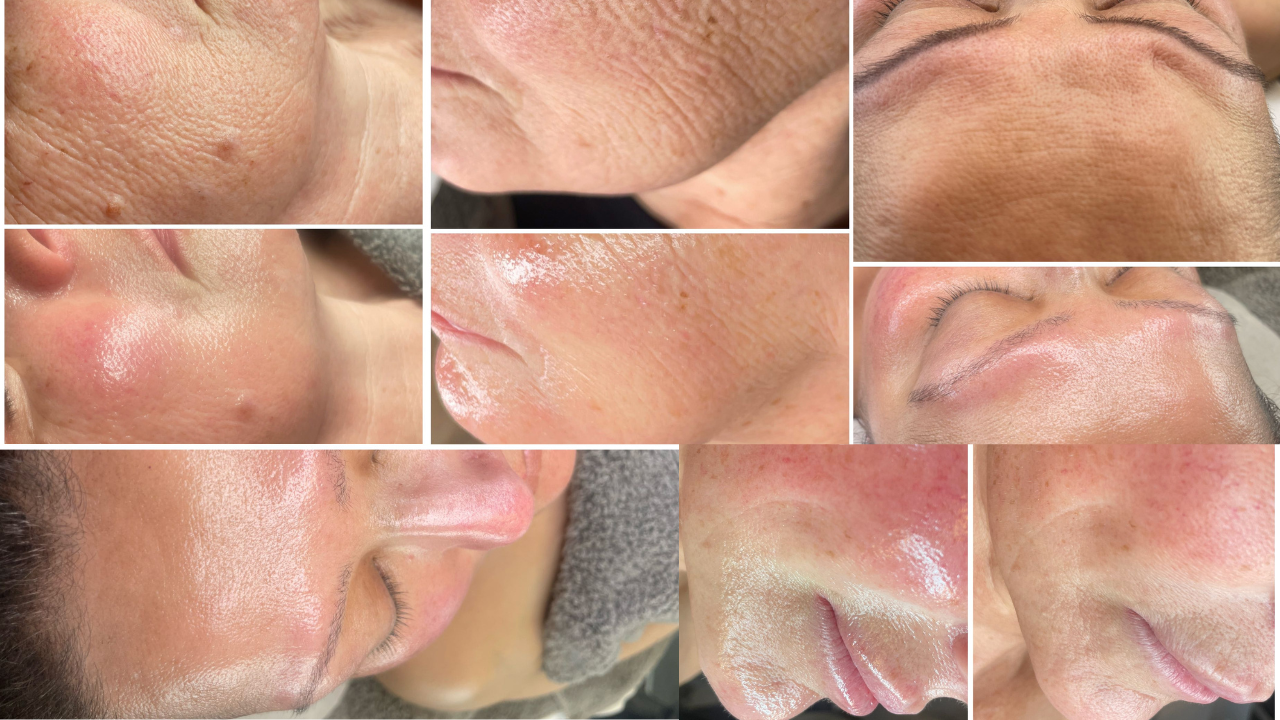 Luxury Treatments Swindon Professional Care