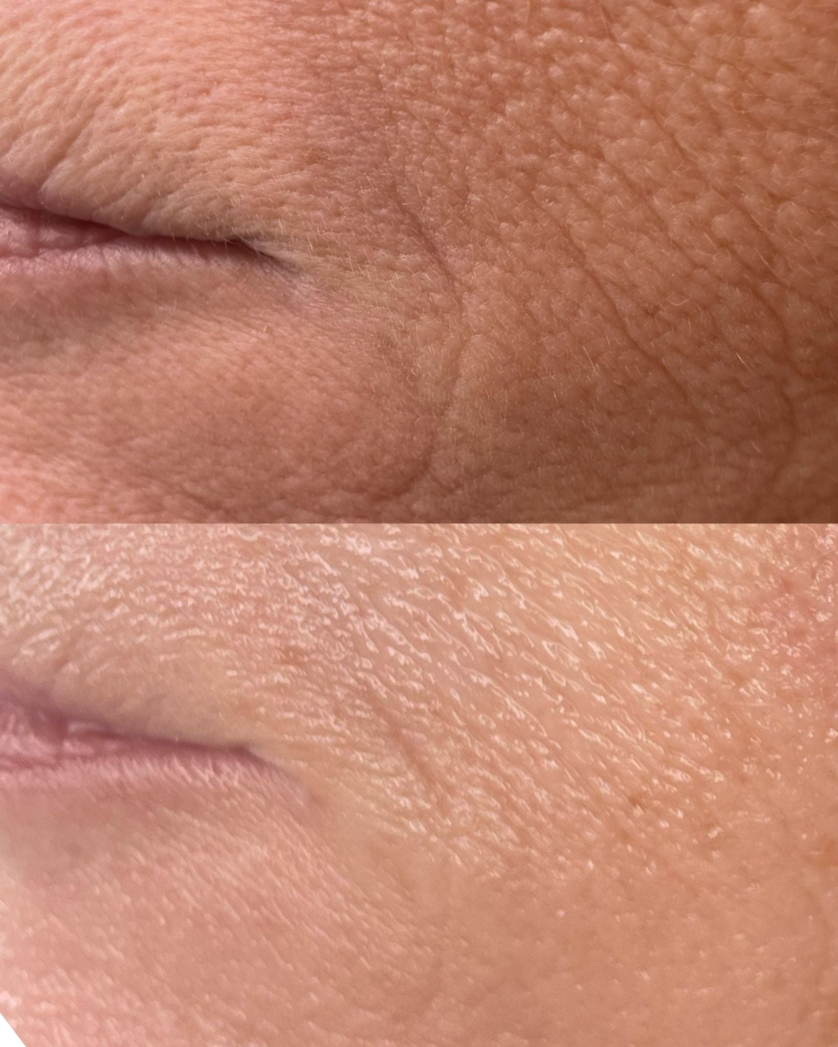 Close-up before and after images showing improved skin texture and reduced wrinkles from buccal facial massage treatment