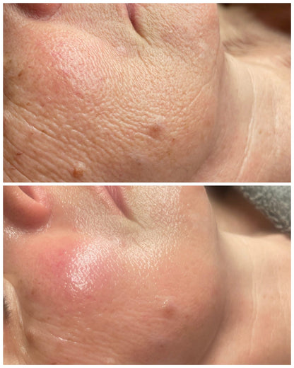 Close-up before and after images showing improved skin texture and reduced wrinkles on cheek after facial massage treatment